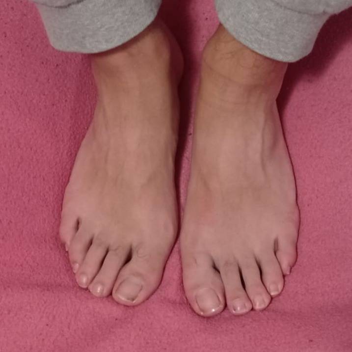 THE B3ST FEET`S OnlyFans – free nudes, naked, leaked