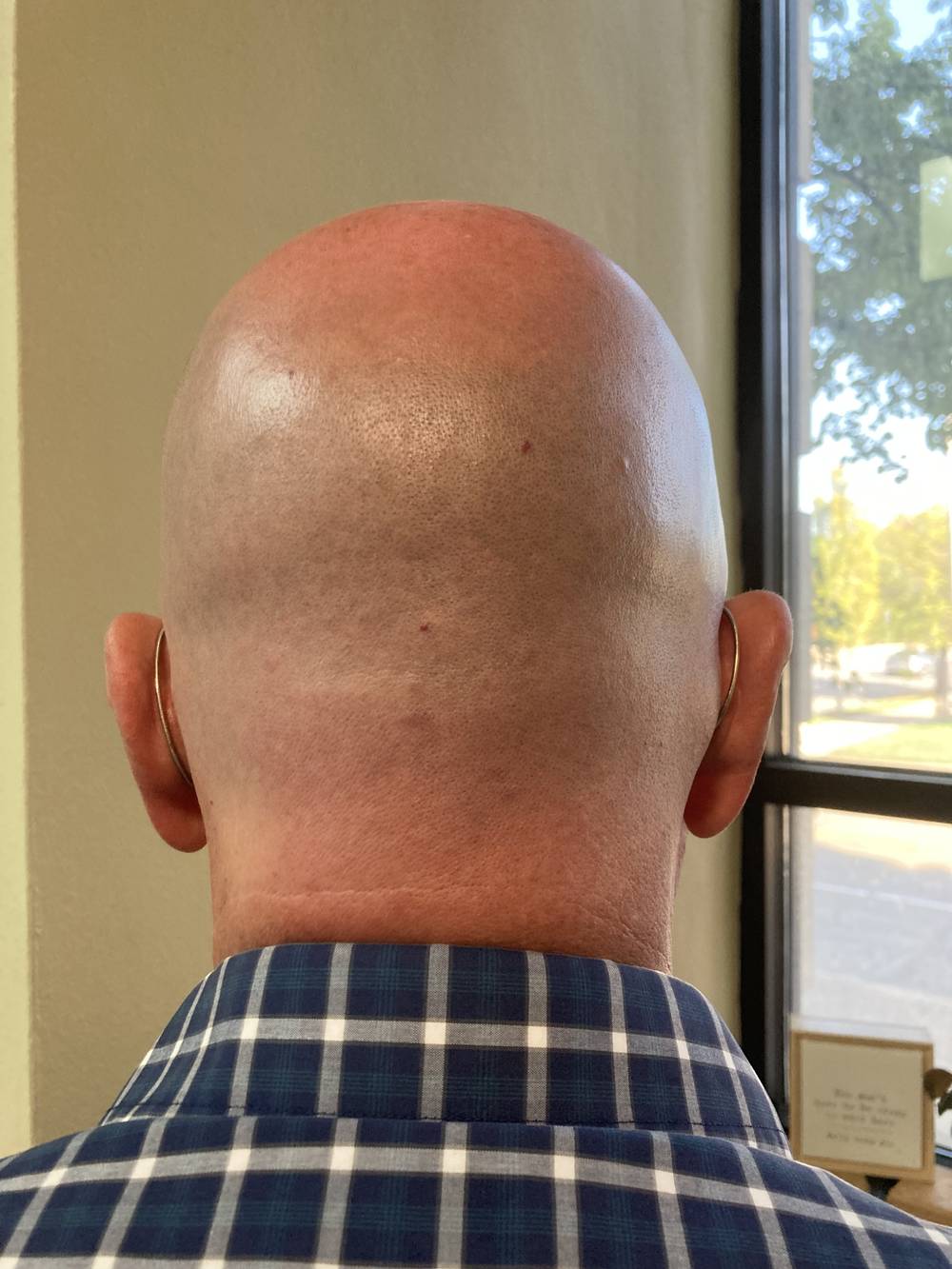 Baldguy