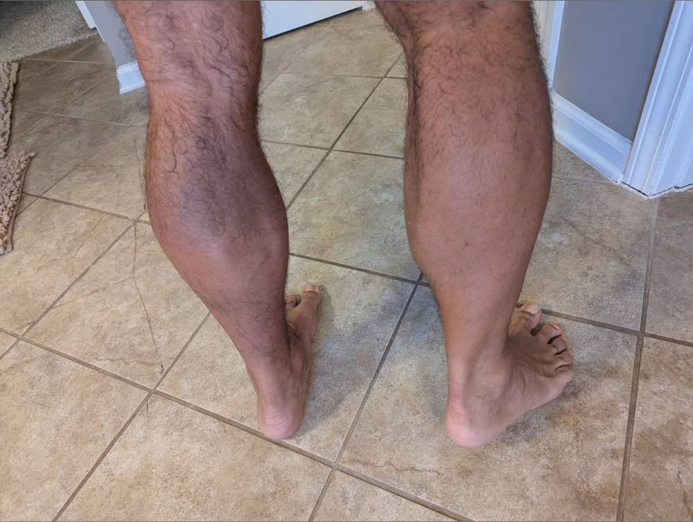 MrCalves